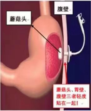 3（请标注：图片源于网络）.jpg