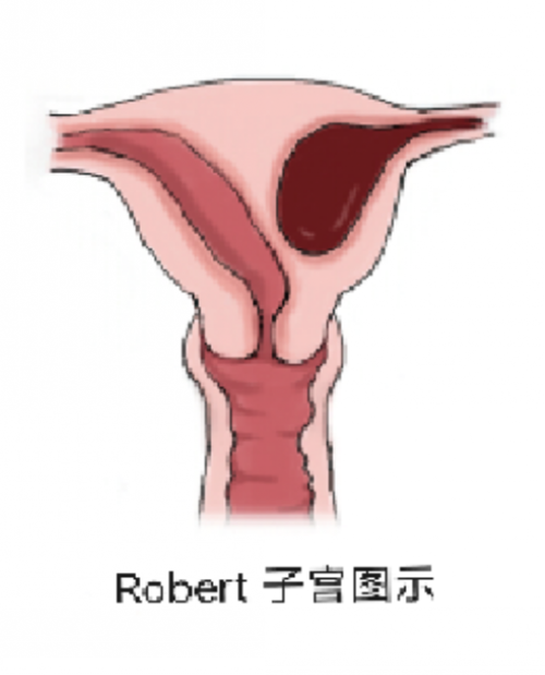 1【“双提升”见行动】子宫畸形手术成功 患者重获新生_conew1.png